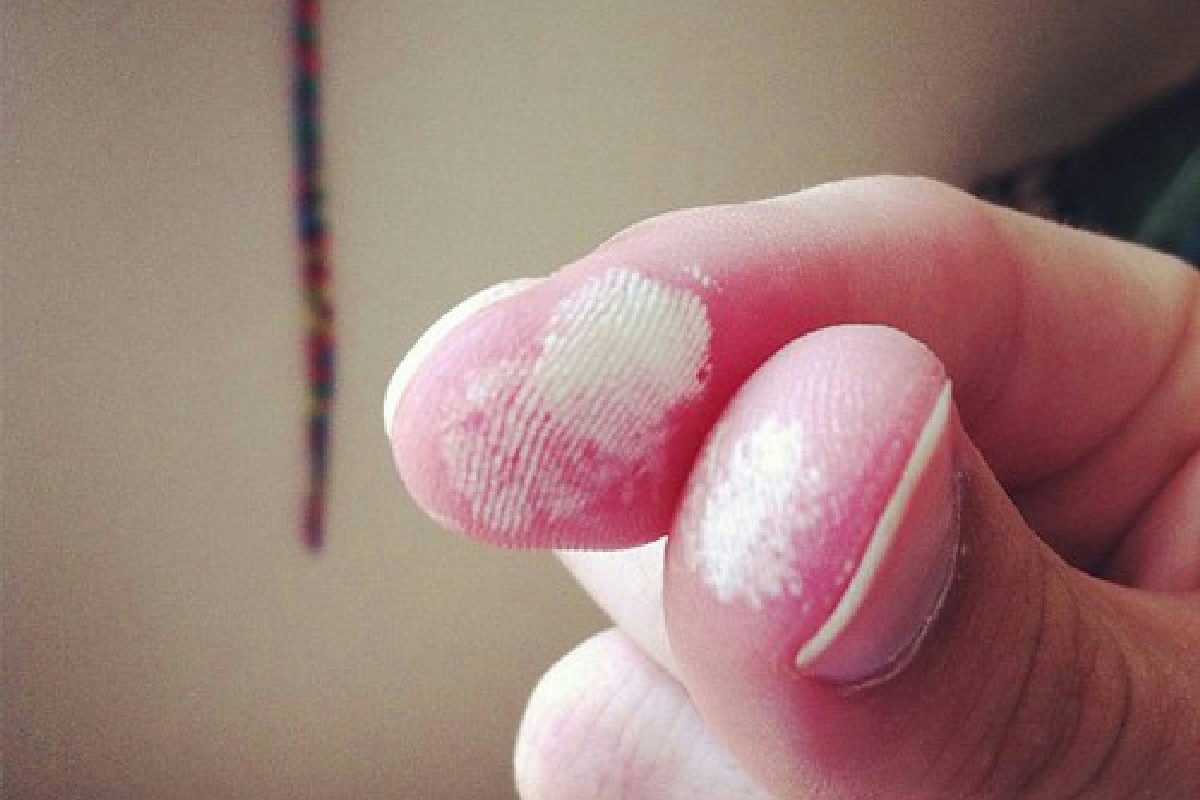 Se l’acqua ossigenata si usa solo per ferire perde valore: l’uso corretto che cambia la routine quotidiana